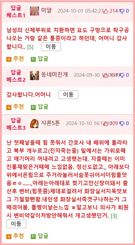 약혐?) 자연분만하는 모습 (실제 아니고 모형임)