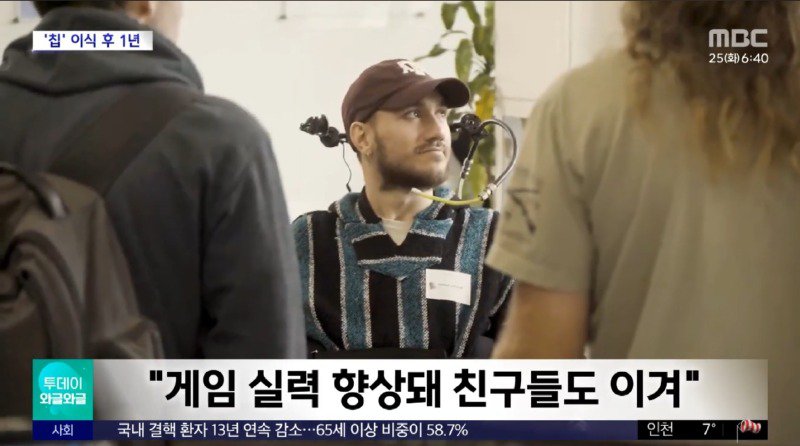 뇌에 뉴럴링크 칩을 박은 전신마비 환자 근황