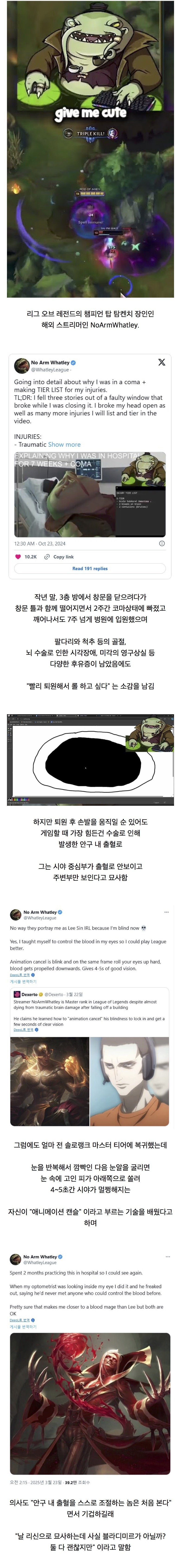  뇌수술 후 앞이 안보이는 롤 스트리머 마스터 복귀 ㄷㄷ 