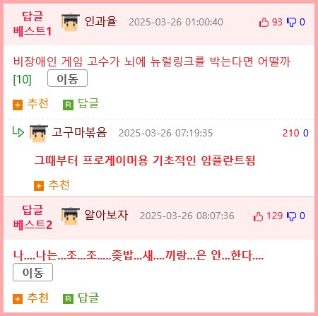 뇌에 뉴럴링크 칩을 박은 전신마비 환자 근황