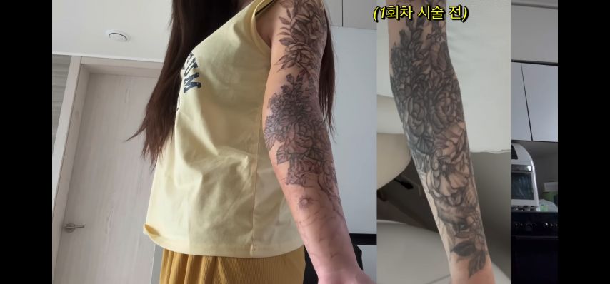 (약혐)문신 제거녀의 후기