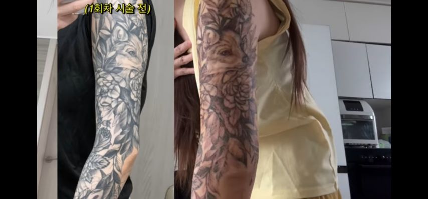 (약혐)문신 제거녀의 후기