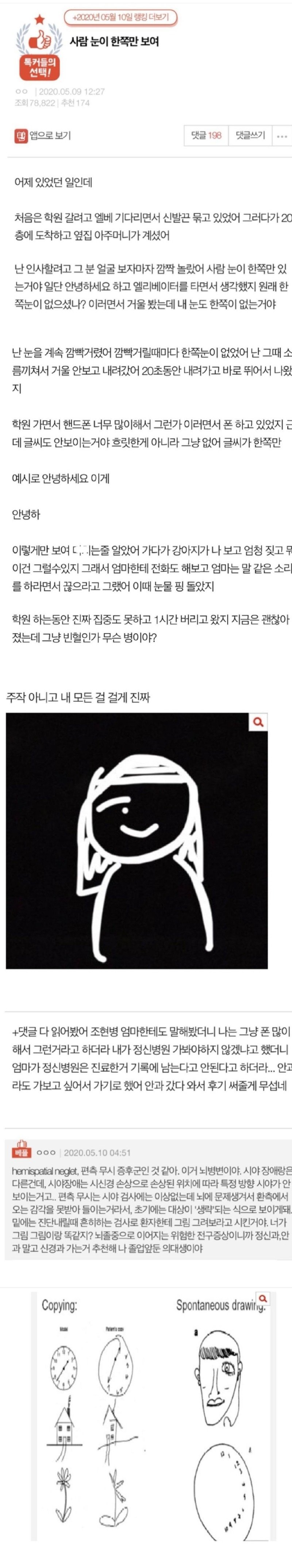 사람 눈이 한쪽만 보여.jpg