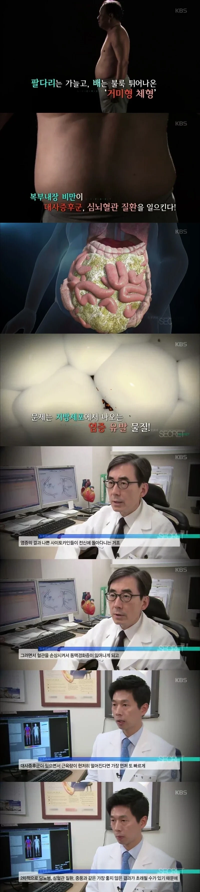 의사피셜 우리 몸에서 가장 치명적인 지방
