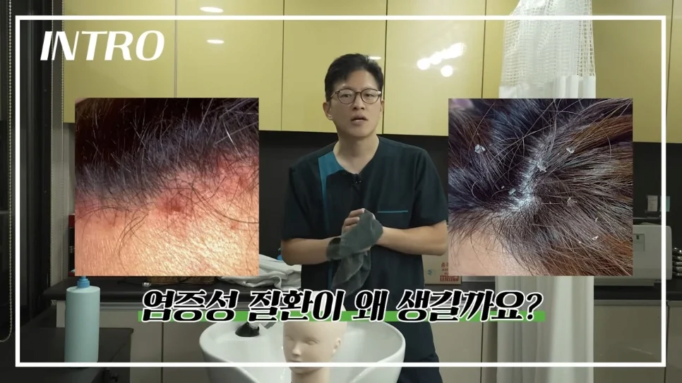 탈모를 만들어내는 최악의 머리감기 습관은 무엇일까?.jpg