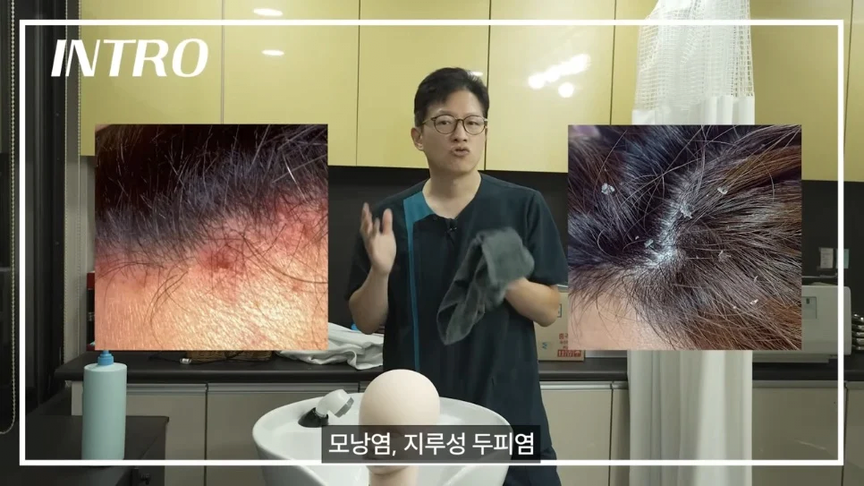 탈모를 만들어내는 최악의 머리감기 습관은 무엇일까?.jpg
