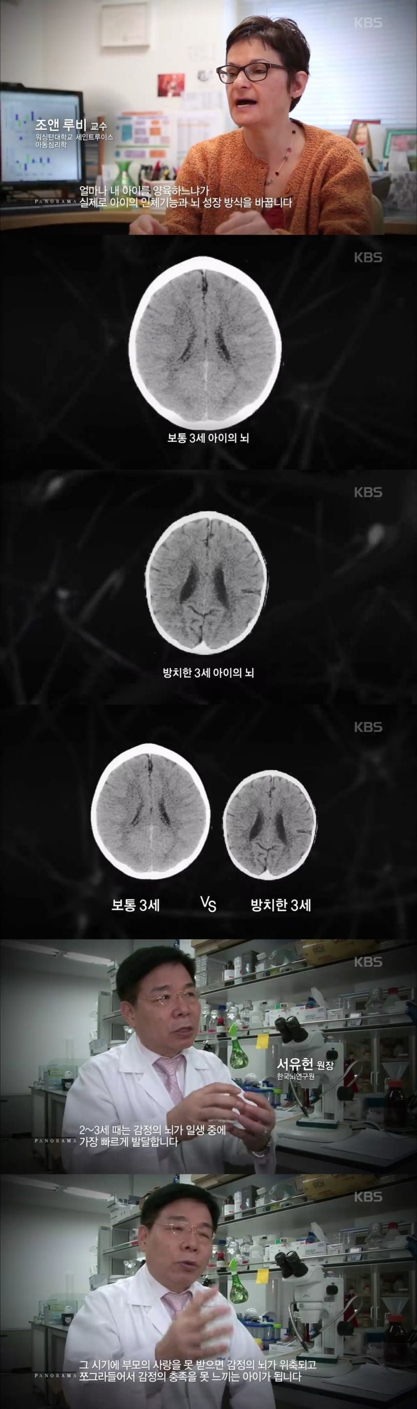 2-3살 아이가 사랑을 받지 못하면 생기는 일