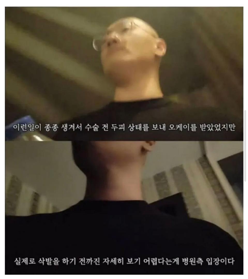 터키로 모발이식 받으러간 남성