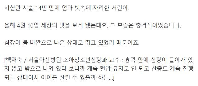 혐) 심장이 밖에서 뛰는 심장이소증, 국내 최초 수술 성공