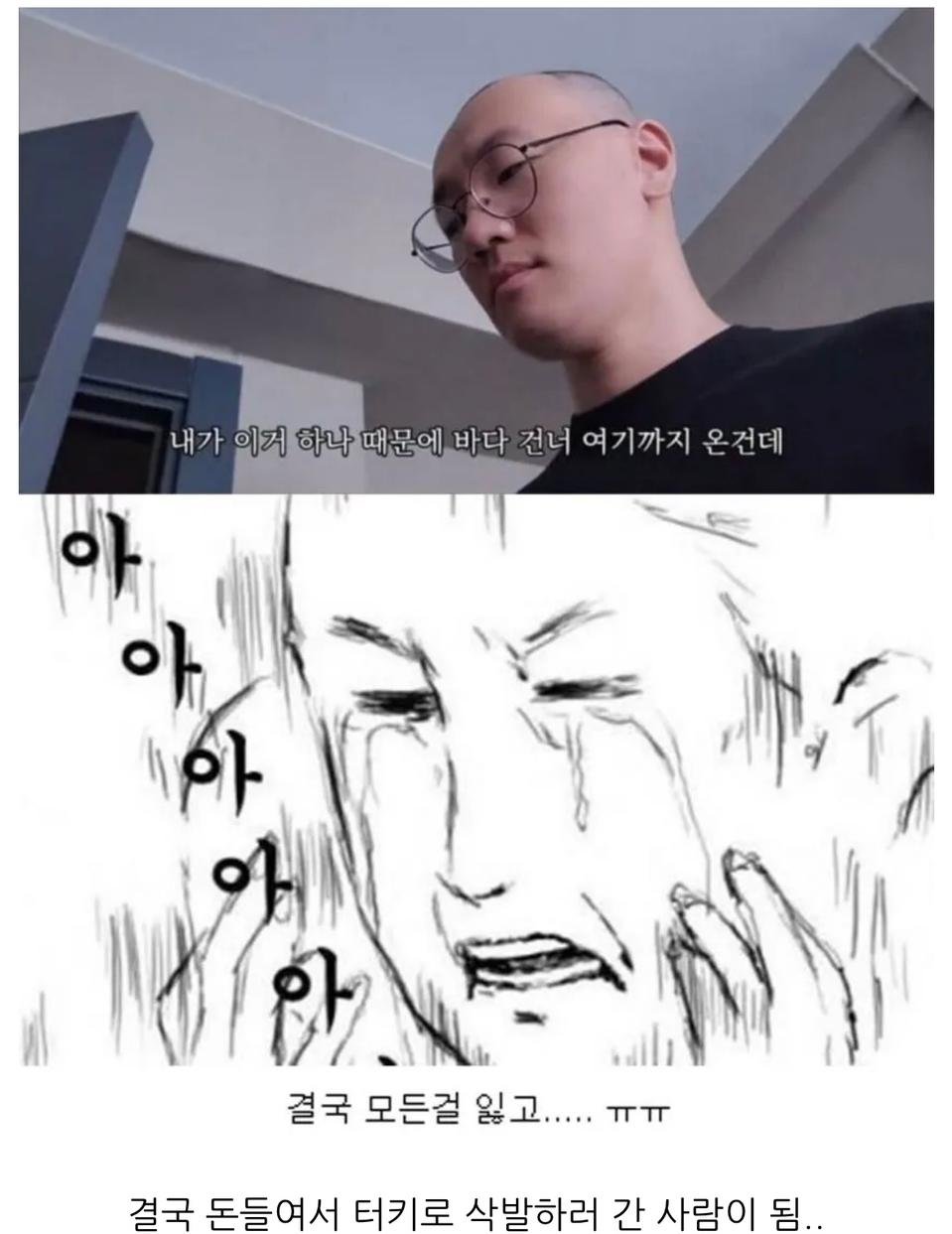 터키로 모발이식 받으러간 남성