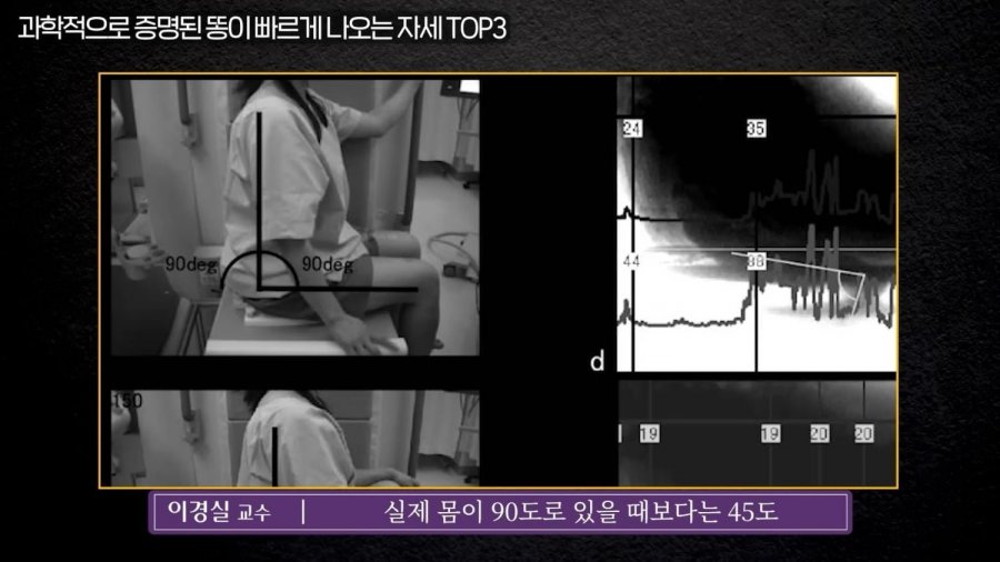 똥 닦는 방향과 똥 잘 나오는 자세