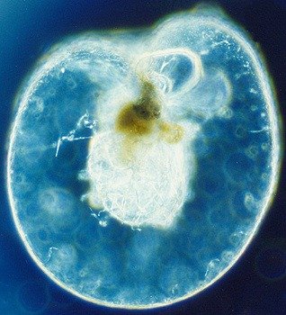 바닷물이 빛나는 게 아니었다;; Noctiluca scintillans