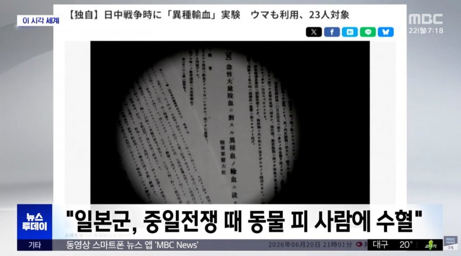 중일 전쟁때 동물 피를 사람에게 수혈하는 실험한 일본군