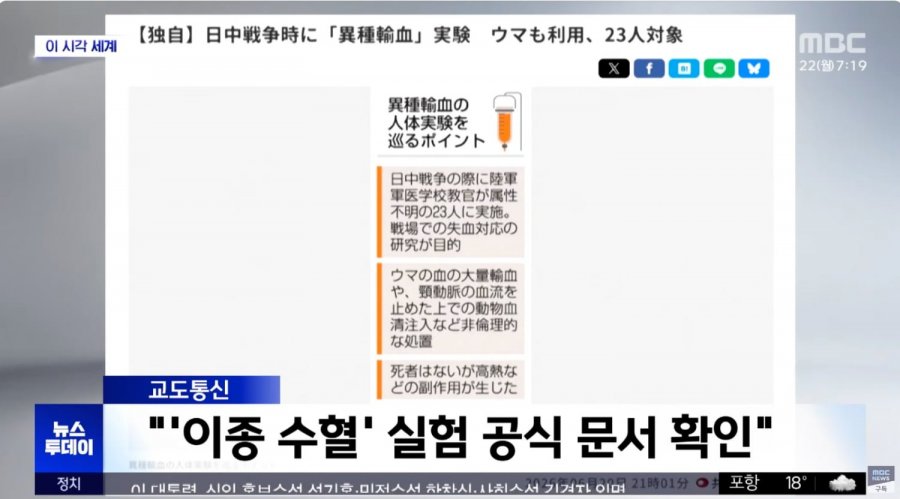 중일 전쟁때 동물 피를 사람에게 수혈하는 실험한 일본군