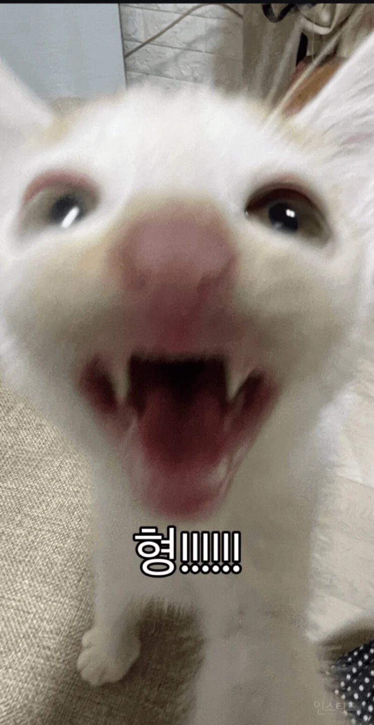 형아 ! 나 드디어 눈 기증받게 됐대 !!!