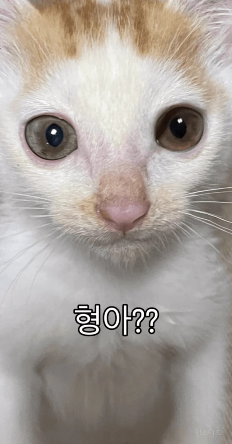 형아 ! 나 드디어 눈 기증받게 됐대 !!!