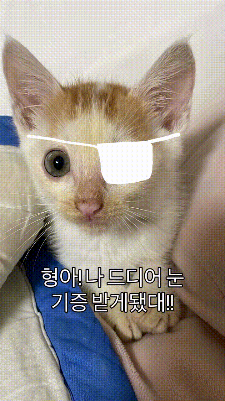 형아 ! 나 드디어 눈 기증받게 됐대 !!!