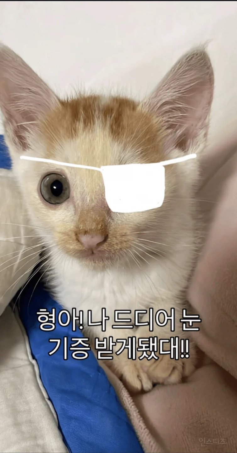 형아 ! 나 드디어 눈 기증받게 됐대 !!!