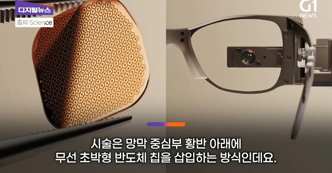 드디어 정복했다는 시각장애 근황